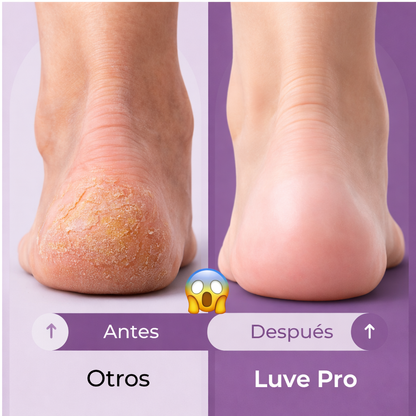 Exfoliador de callos Luve Pro