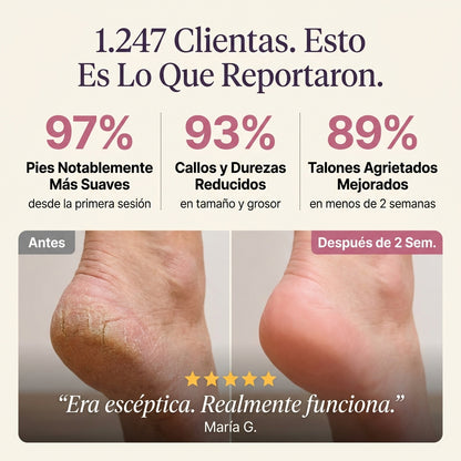 Exfoliador de callos Luve Pro