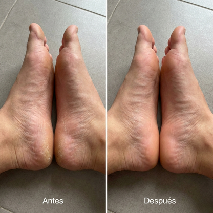 Exfoliador de callos Luve Pro
